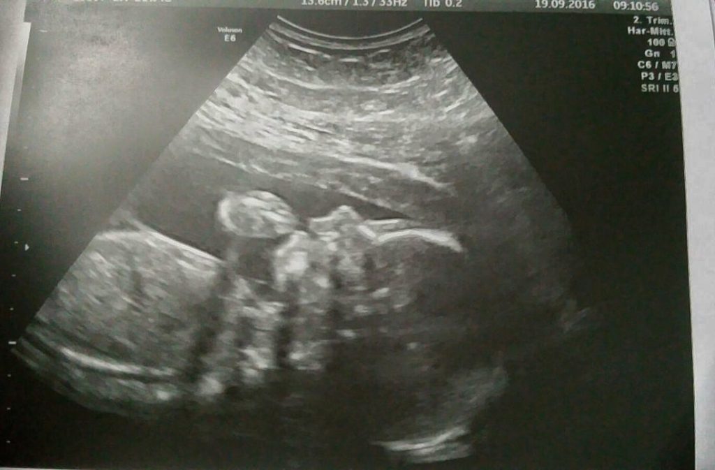 Ungeborener Embryo